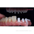 Full Arch Zirconia Malo Bridge